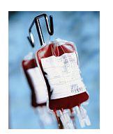 Transfuzia sangvina