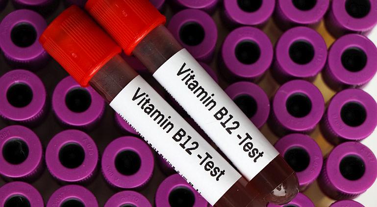 Anemia prin deficit de vitamina B12 (Anemia pernicioasa)