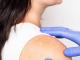 Vitiligo: simptome, diagnostic, factori de risc, complicatii, tratament
